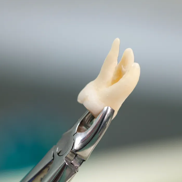 Oral surgery procedures