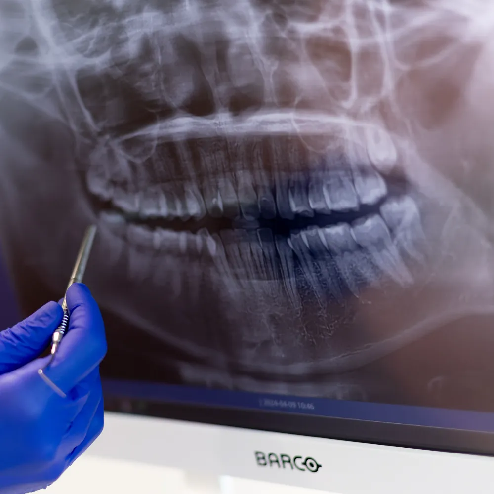 Dental Assessment with Free Panoramic X-ray or 3D CBCT